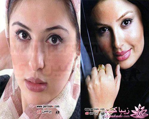 قبل و بعد از عمل بازیگران ایرانی